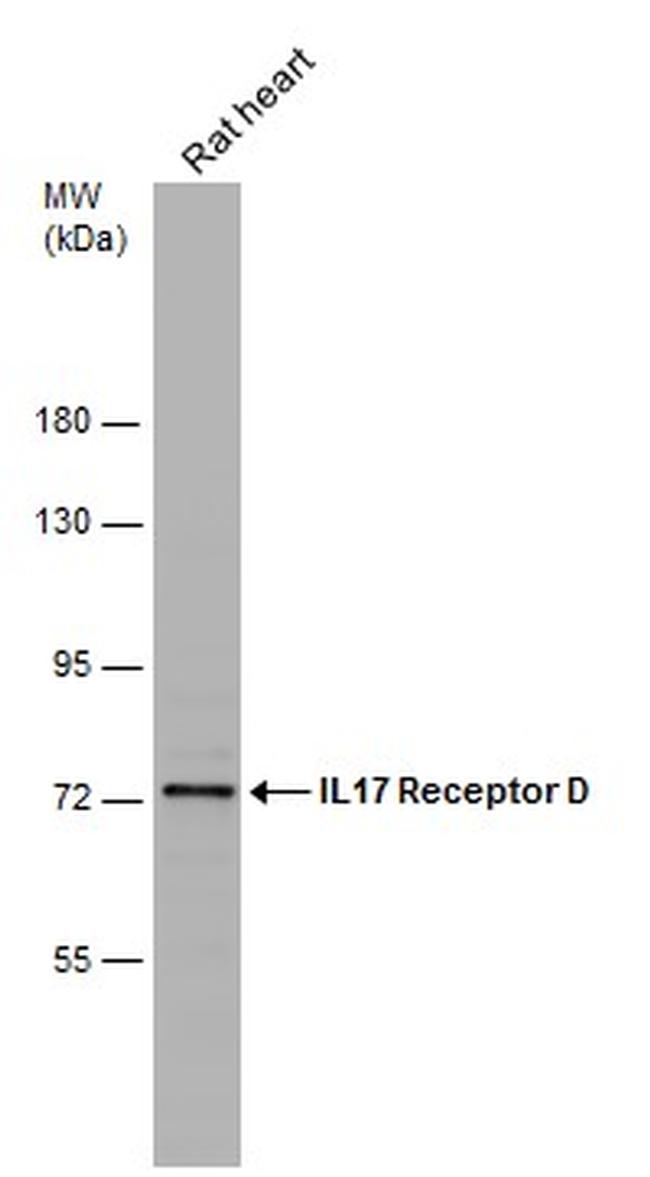 IL17RD Antibody in Western Blot (WB)