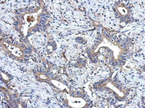 MRPL18 Antibody in Immunohistochemistry (Paraffin) (IHC (P))