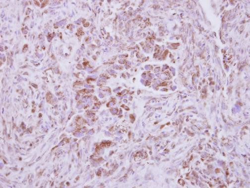 NAPRT1 Antibody in Immunohistochemistry (Paraffin) (IHC (P))