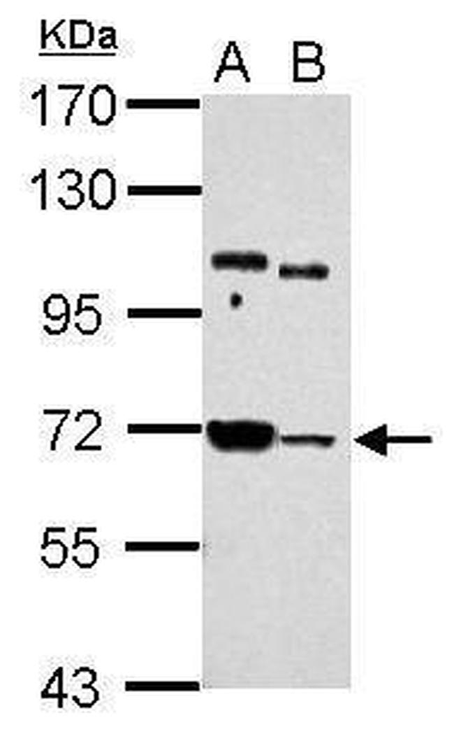 STS1 Antibody in Western Blot (WB)