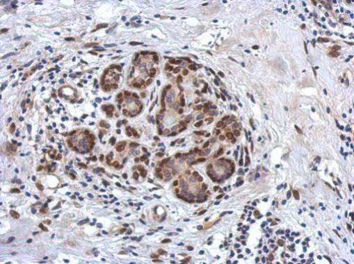 ZBTB20 Antibody in Immunohistochemistry (Paraffin) (IHC (P))