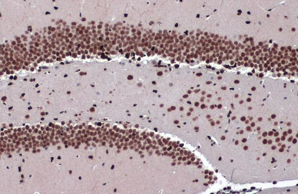 ZBTB20 Antibody in Immunohistochemistry (Paraffin) (IHC (P))