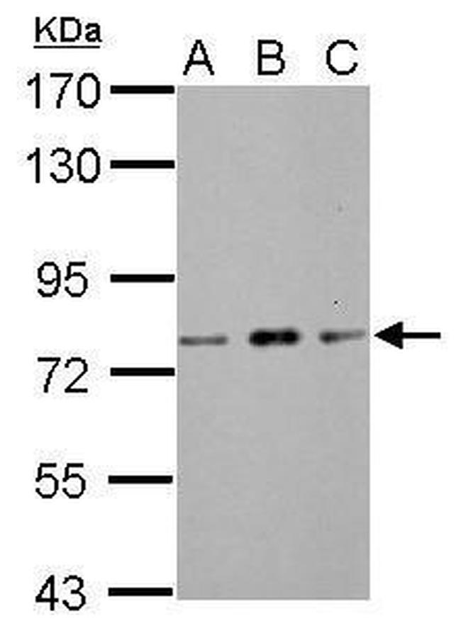 ZBTB20 Antibody in Western Blot (WB)