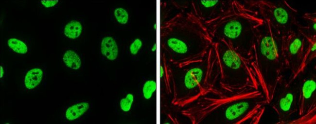 H3K4me2 Antibody in Immunocytochemistry (ICC/IF)