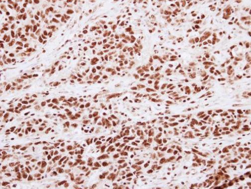 H3K4me2 Antibody in Immunohistochemistry (Paraffin) (IHC (P))