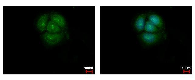 AKT Pan Antibody in Immunocytochemistry (ICC/IF)