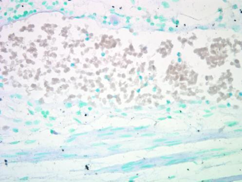 AKT Pan Antibody in Immunohistochemistry (IHC)