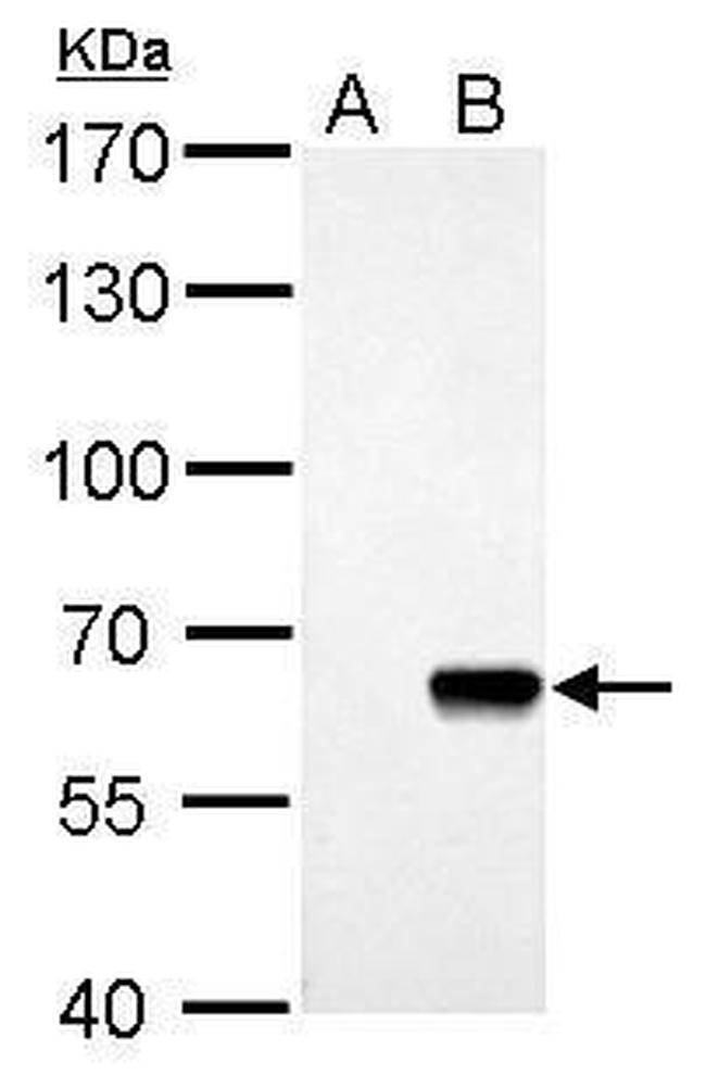 AKT Pan Antibody in Western Blot (WB)