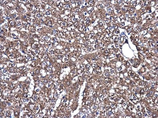 MEK1/MEK2 Antibody in Immunohistochemistry (Paraffin) (IHC (P))