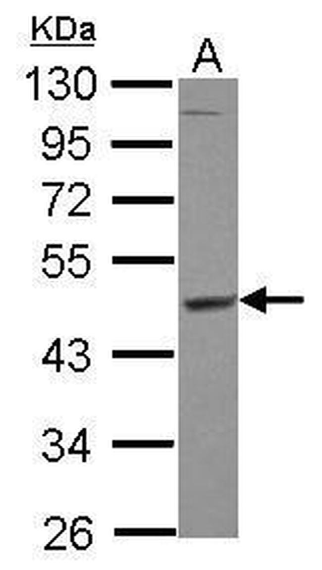 MEK1/MEK2 Antibody in Western Blot (WB)