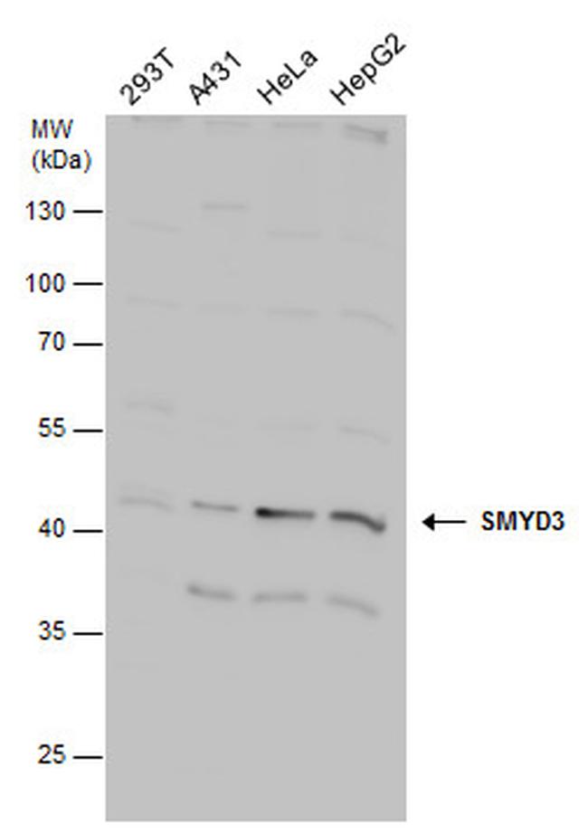 SMYD3 Antibody in Western Blot (WB)