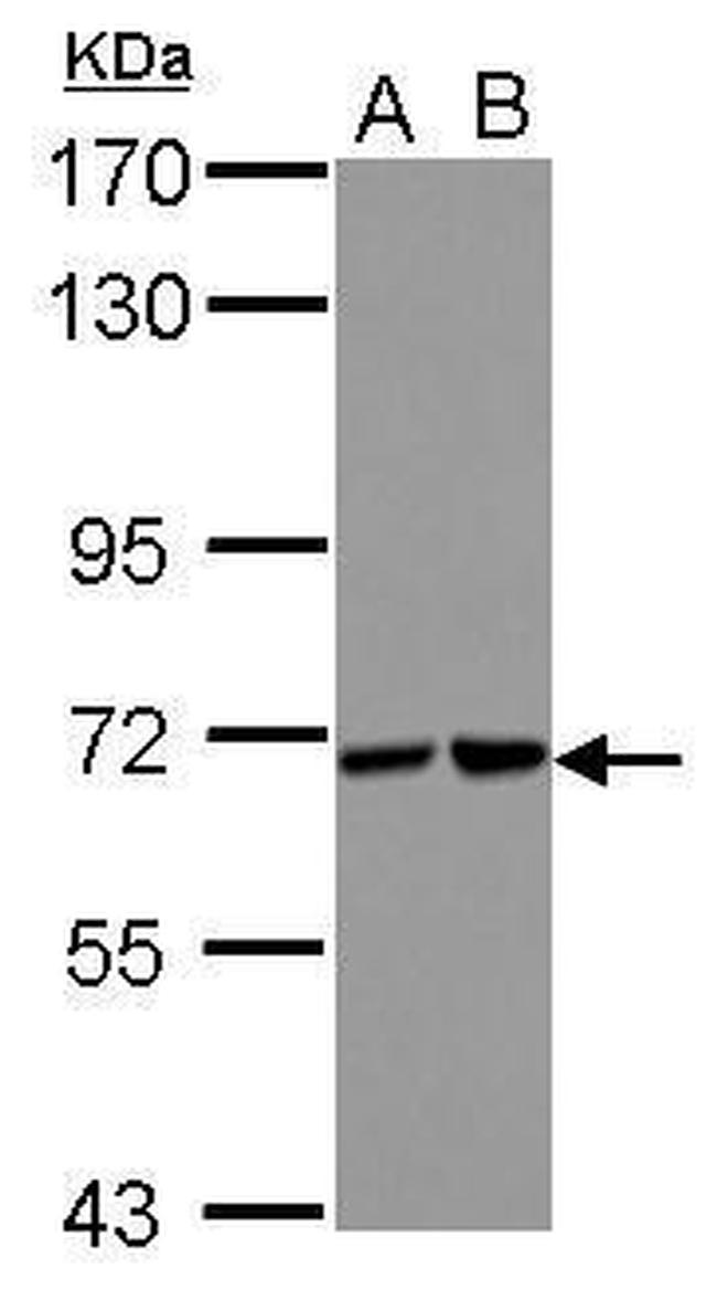 STS1 Antibody in Western Blot (WB)