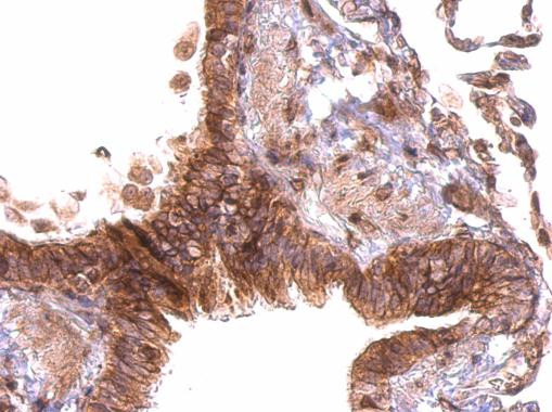 PABPC4 Antibody in Immunohistochemistry (Paraffin) (IHC (P))