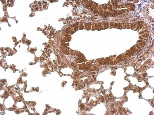 PABPC4 Antibody in Immunohistochemistry (Paraffin) (IHC (P))