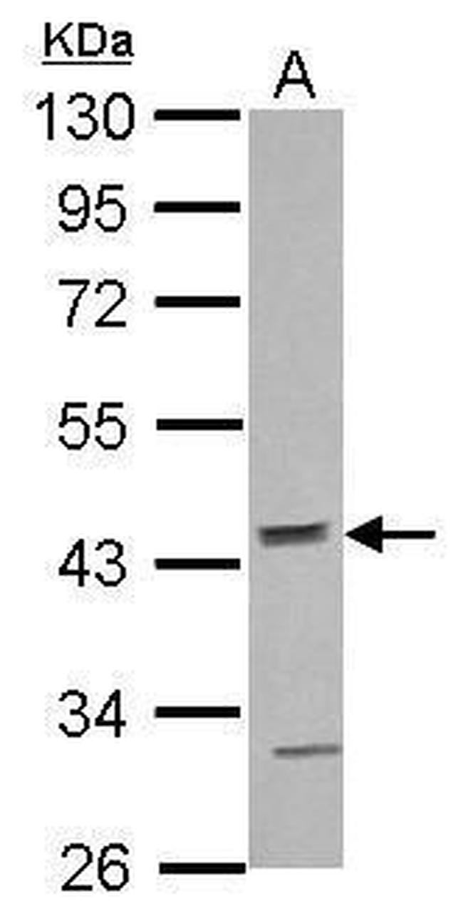 ACTR10 Antibody in Western Blot (WB)