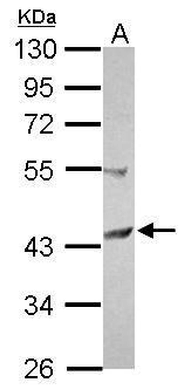 SCCPDH Antibody in Western Blot (WB)