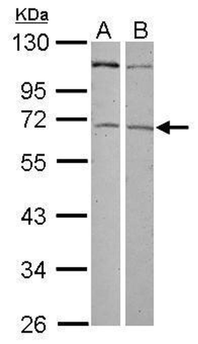 ZNF503 Antibody in Western Blot (WB)