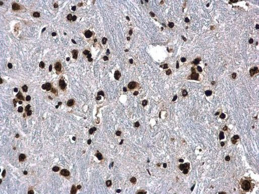 Histone H3 Antibody in Immunohistochemistry (Paraffin) (IHC (P))