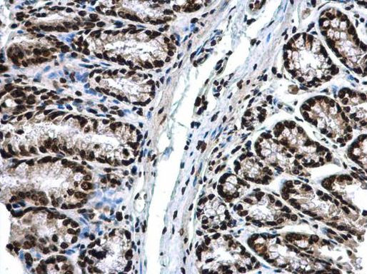 Histone H3 Antibody in Immunohistochemistry (Paraffin) (IHC (P))