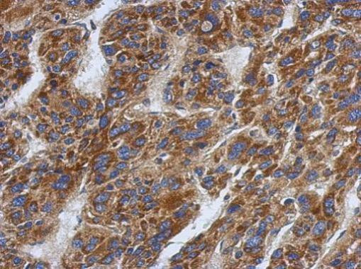 SFXN1 Antibody in Immunohistochemistry (Paraffin) (IHC (P))