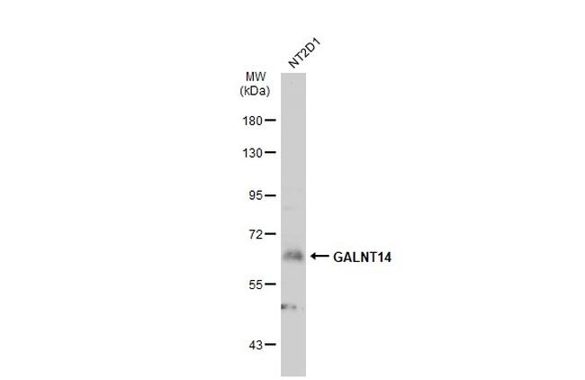 GALNT14 Antibody in Western Blot (WB)