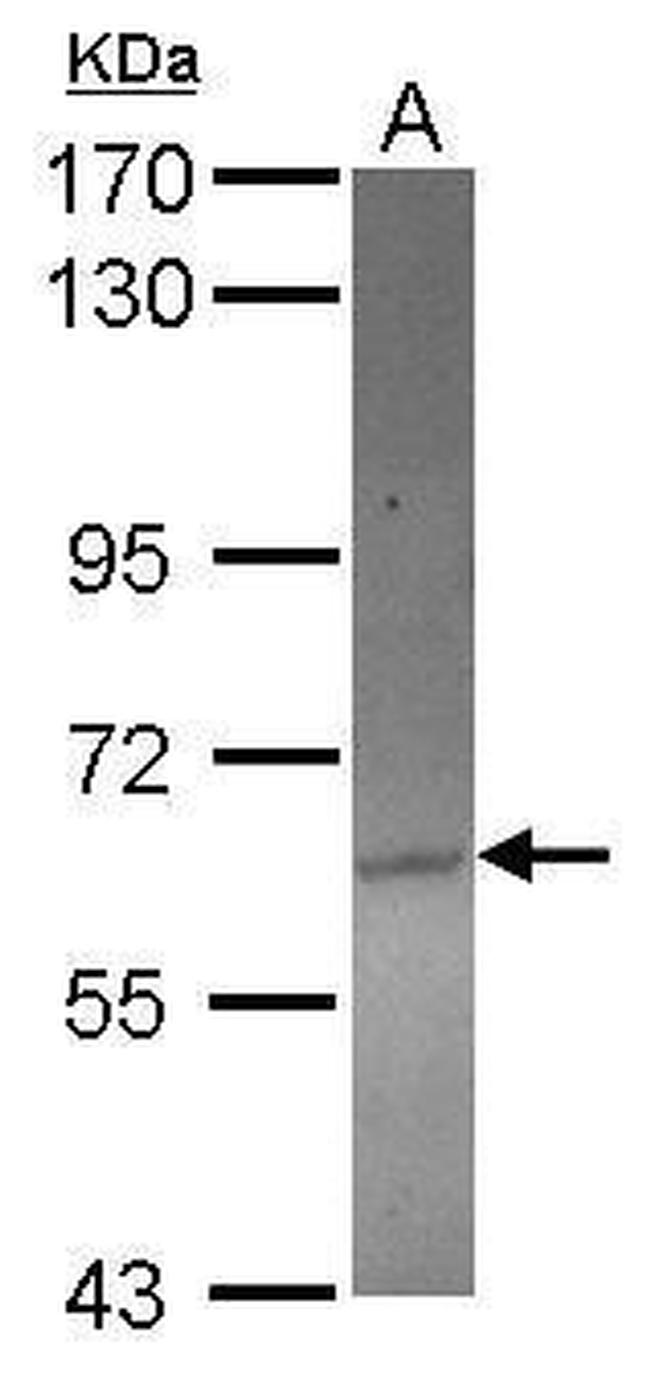 ACOT12 Antibody in Western Blot (WB)