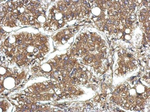 CYFIP1 Antibody in Immunohistochemistry (Paraffin) (IHC (P))