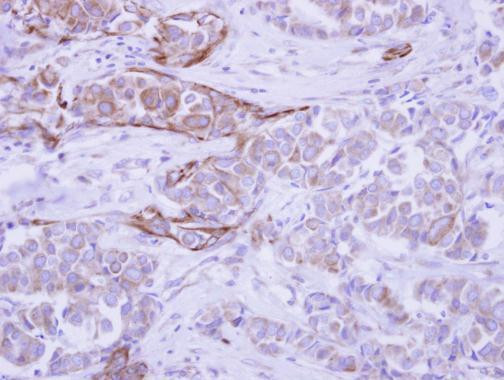 WDR49 Antibody in Immunohistochemistry (Paraffin) (IHC (P))