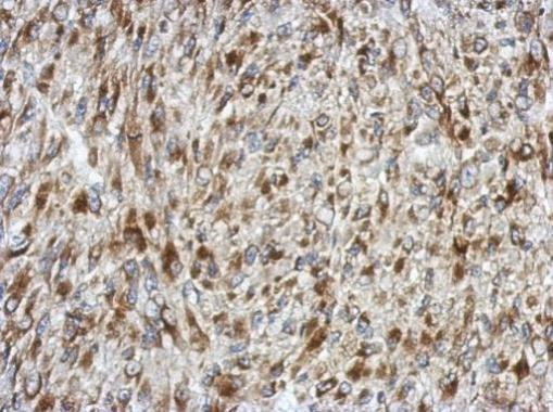 SDF4 Antibody in Immunohistochemistry (Paraffin) (IHC (P))