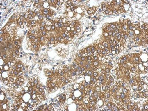 LCN15 Antibody in Immunohistochemistry (Paraffin) (IHC (P))