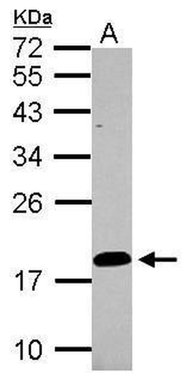 LCN15 Antibody in Western Blot (WB)