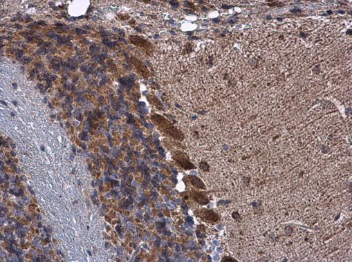 KBTBD3 Antibody in Immunohistochemistry (Paraffin) (IHC (P))