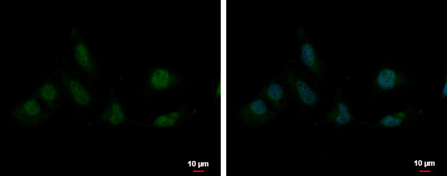 SAP130 Antibody in Immunocytochemistry (ICC/IF)