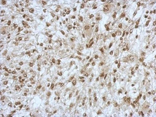 SAP130 Antibody in Immunohistochemistry (Paraffin) (IHC (P))