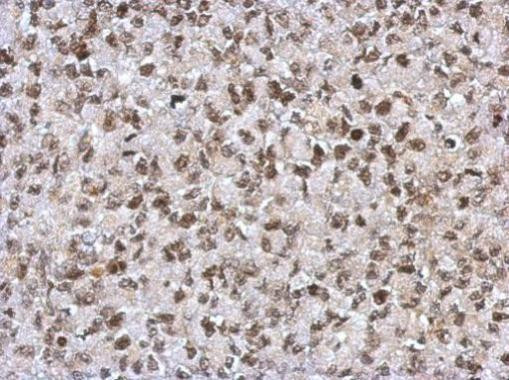 SAP130 Antibody in Immunohistochemistry (Paraffin) (IHC (P))