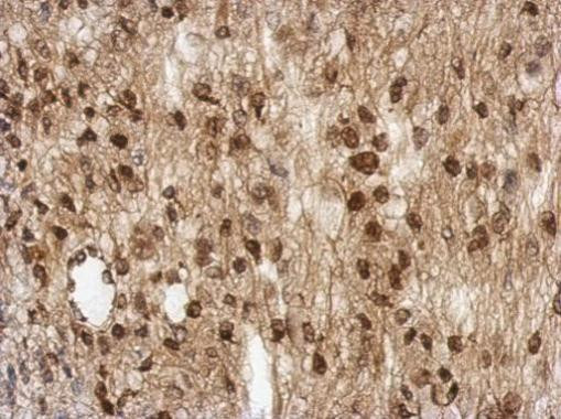 TBC1D22A Antibody in Immunohistochemistry (Paraffin) (IHC (P))