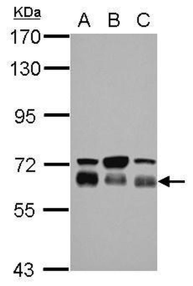 TBC1D22A Antibody in Western Blot (WB)