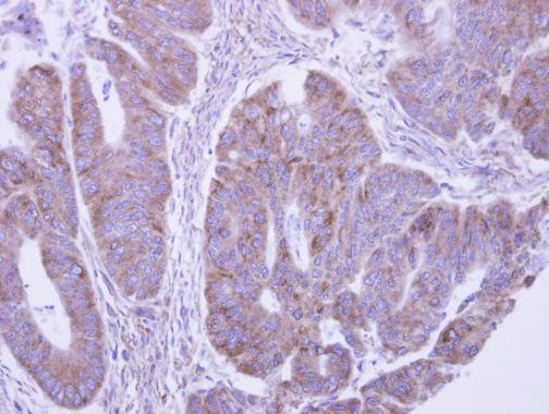 LACTB2 Antibody in Immunohistochemistry (Paraffin) (IHC (P))