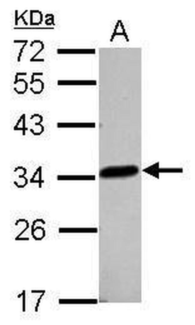 LACTB2 Antibody in Western Blot (WB)