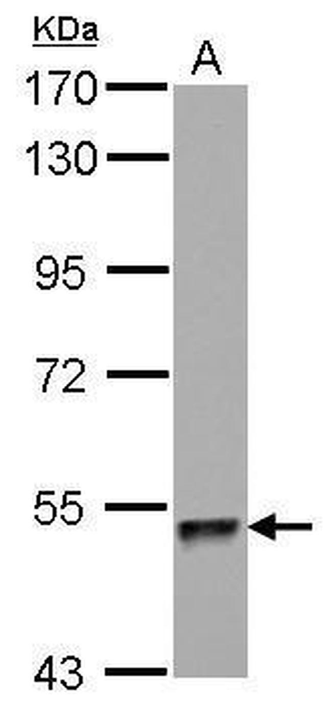 ZNF689 Antibody in Western Blot (WB)