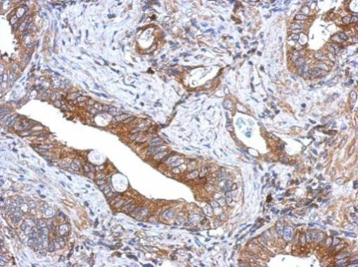 GCNT3 Antibody in Immunohistochemistry (Paraffin) (IHC (P))