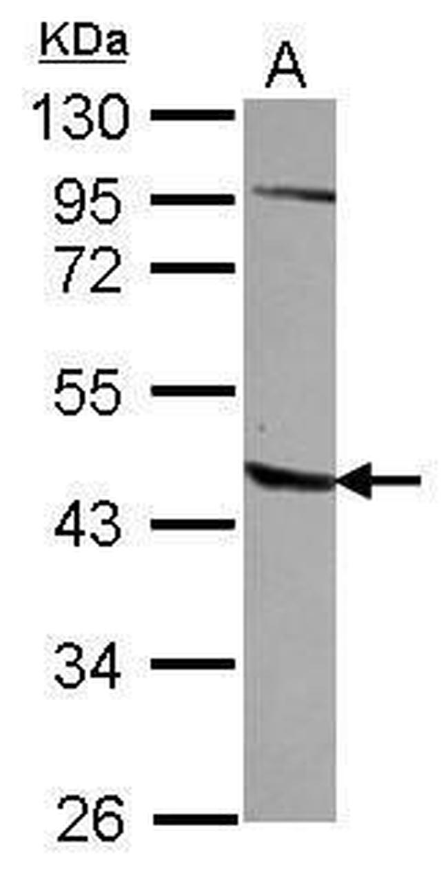 AGPAT5 Antibody in Western Blot (WB)