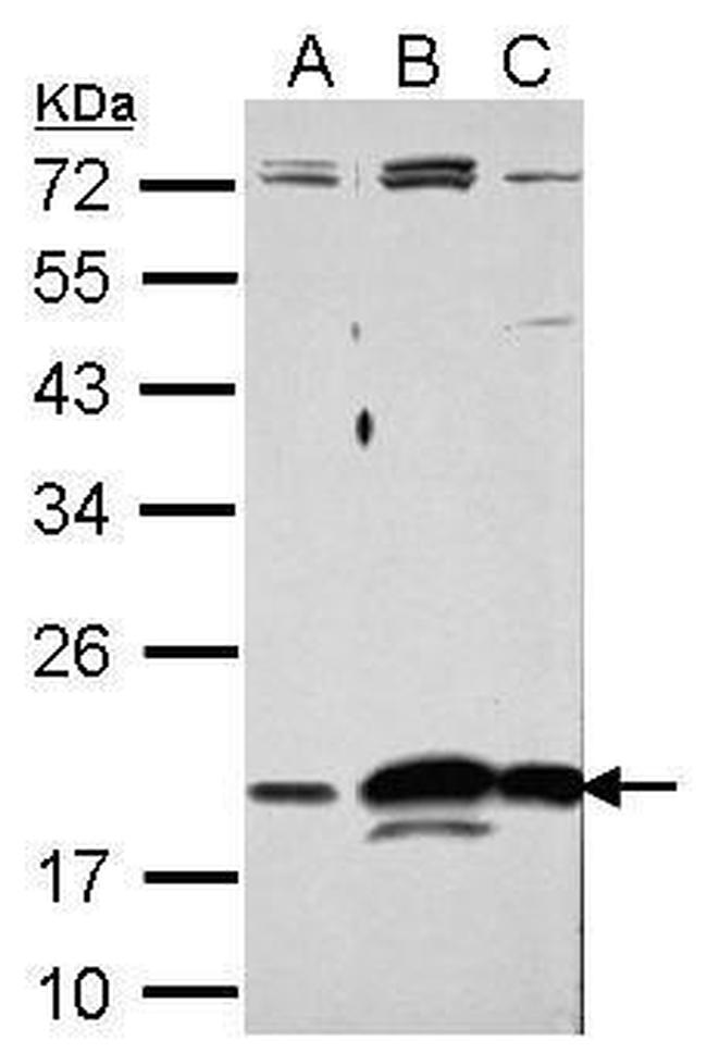 RNase11 Antibody in Western Blot (WB)