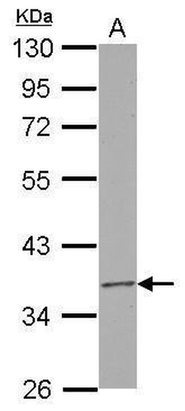 RPUSD3 Antibody in Western Blot (WB)