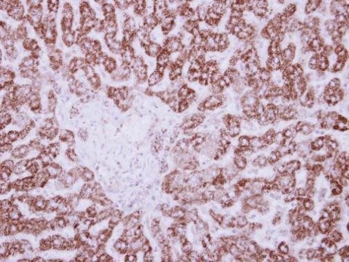 HIBADH Antibody in Immunohistochemistry (Paraffin) (IHC (P))