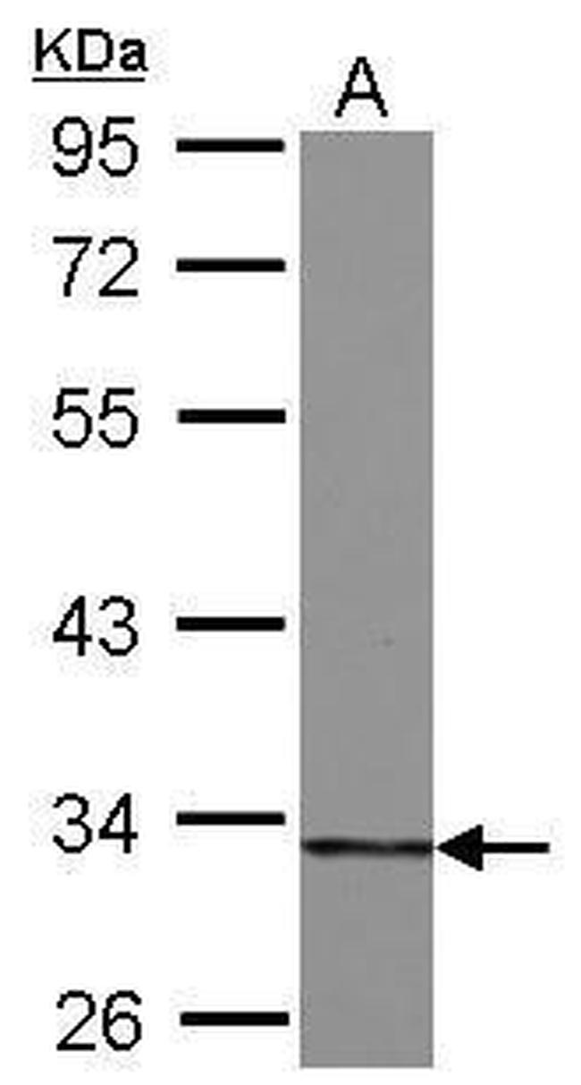 HIBADH Antibody in Western Blot (WB)