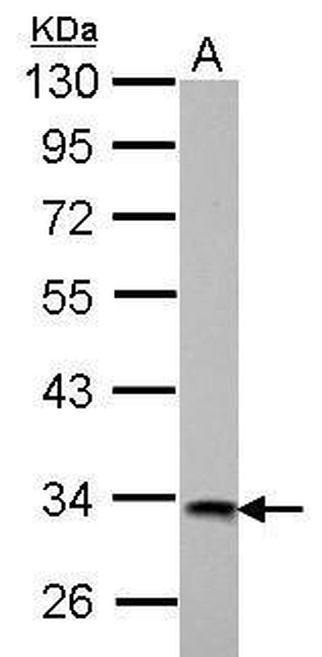 HIBADH Antibody in Western Blot (WB)