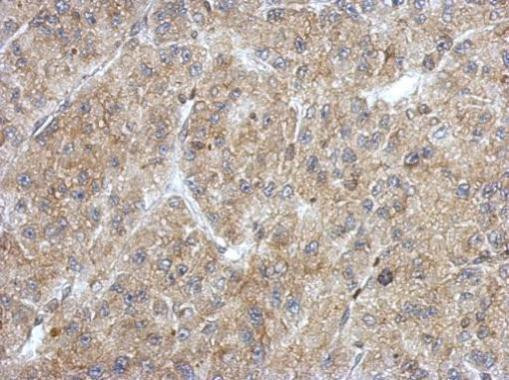 ANKRD53 Antibody in Immunohistochemistry (Paraffin) (IHC (P))