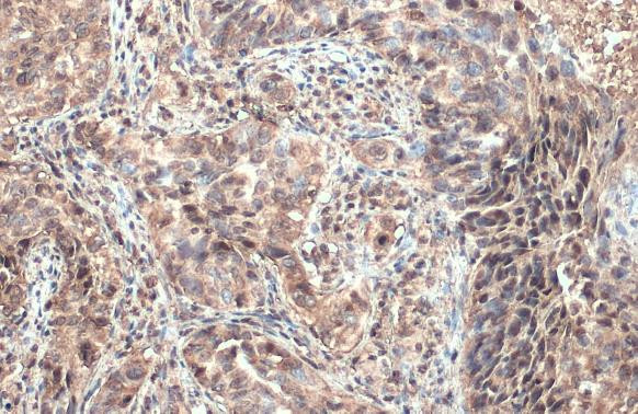 ULBP1 Antibody in Immunohistochemistry (Paraffin) (IHC (P))