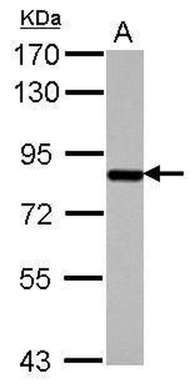 SUPV3L1 Antibody in Western Blot (WB)